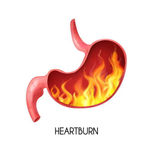 Avoid foods that cause acid reflux