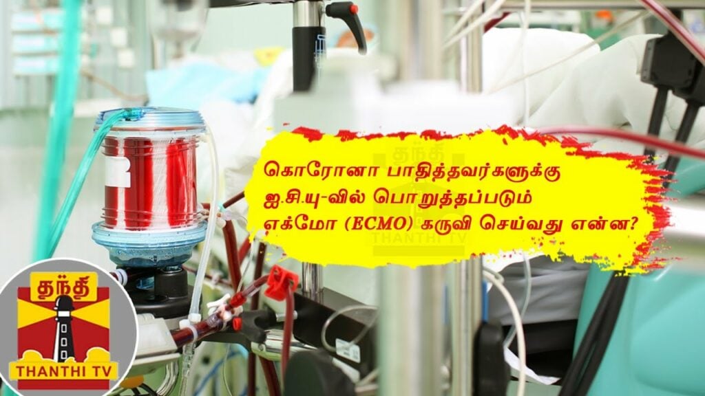 ECMO process explained