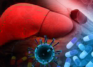 Autoimmune Disease: Causes, Symptoms, and Treatment