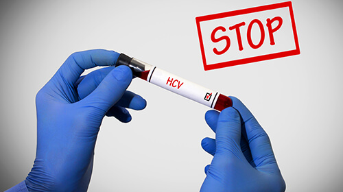 The Answers To All Your Questions Related To Hepatitis C