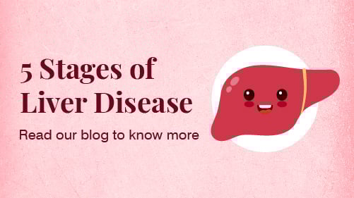 5 Liver Failure Stages or Liver Cirrhosis Stages – Liver Disease 5 Liver Failure Stages or Liver Cirrhosis Stages – Liver Disease