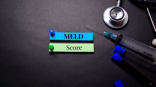 MELD Score – Importance In Liver Transplantation