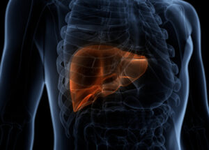 Managing And Treating Liver Failure