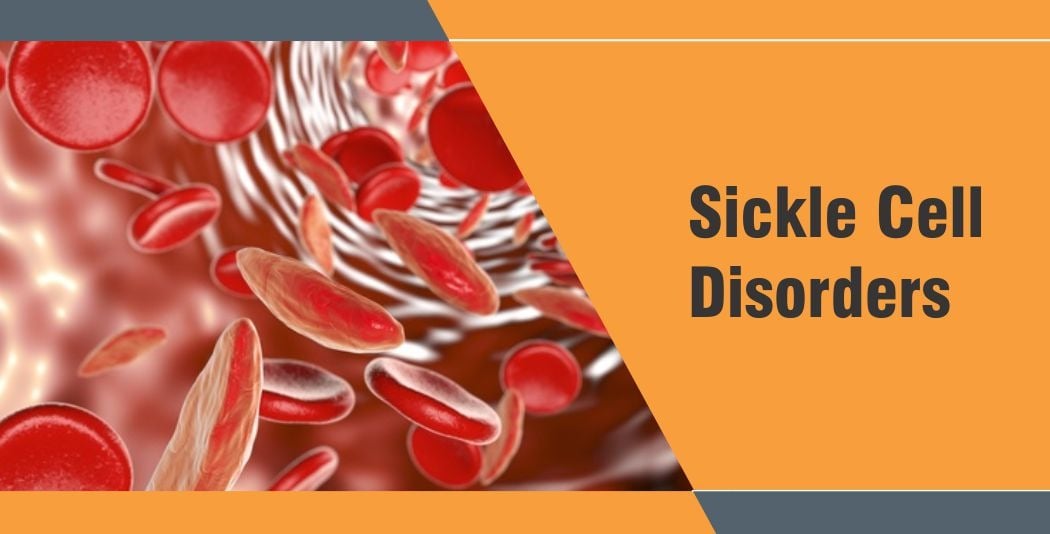 Sickle Cell Disorder – Causes, Symptoms, and Treatment