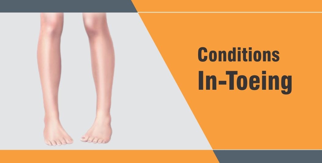 In-Toeing In-Toeing