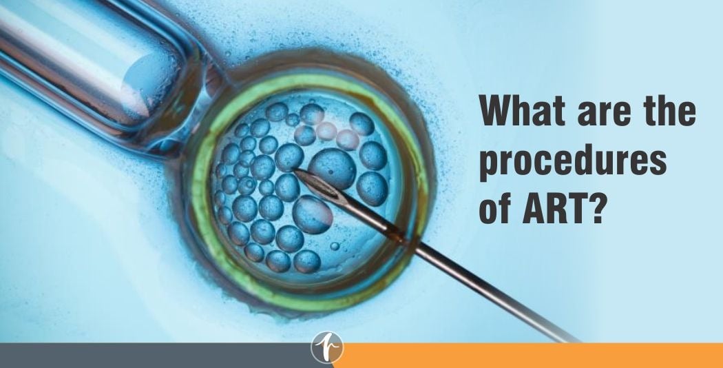 What are the procedures of ART? What are the procedures of ART?