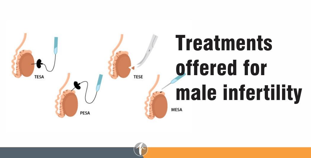 Treatments offered for male infertility