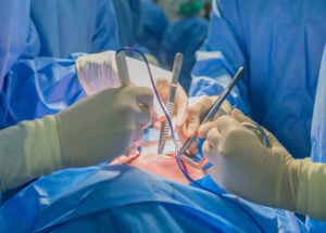 What is a Heart Transplant?