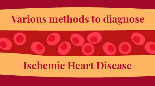 Understanding Ischemic Heart Disease – Symptoms, Diagnosis & Treatment