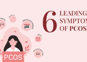 Polycystic Ovarian Syndrome (PCOS) – Symptoms and Causes