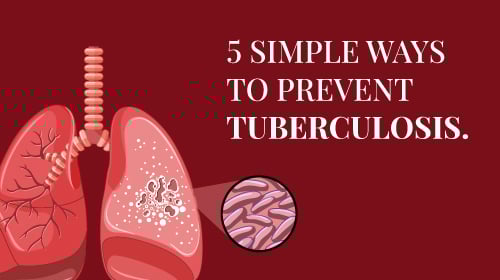 Tuberculosis (TB): Symptoms, Types, Diagnosis, and Treatment Tuberculosis (TB): Symptoms, Types, Diagnosis, and Treatment