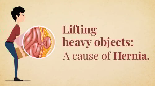 What is Hernia? Symptoms, Causes, Diagnosis & Treatment Explained What is Hernia? Symptoms, Causes, Diagnosis & Treatment Explained