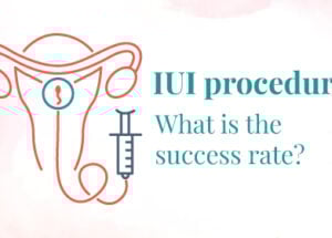 What is IUI Treatment: Procedure, Preparation, and Risks