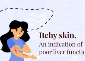 What is a Liver Function Test? Purpose, Types, Preparation, and Post-Test Care