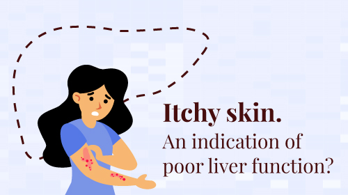 What is a liver function test?