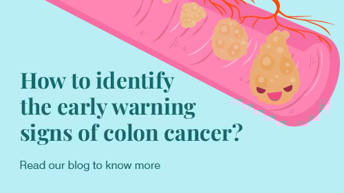 What is Colon Cancer? Causes, Symptoms, and Treatment Options