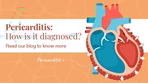 What is Pericardium? What is Pericardium?