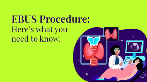 All About EBUS Procedure