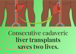 Liver transplants performed at Stanley Hospital in Chennai led by doctors from Rela Hospital