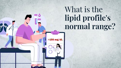 What is a lipid profile test? What is a lipid profile test?