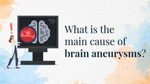 Brain Aneurysm – Symptoms and Causes Brain Aneurysm – Symptoms and Causes
