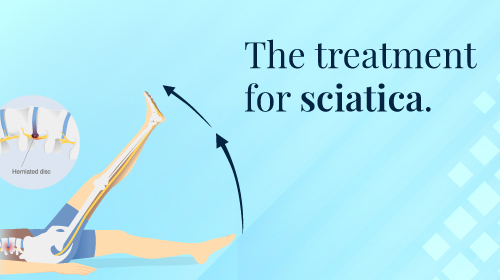 How to Cure Sciatica Permanently How to Cure Sciatica Permanently