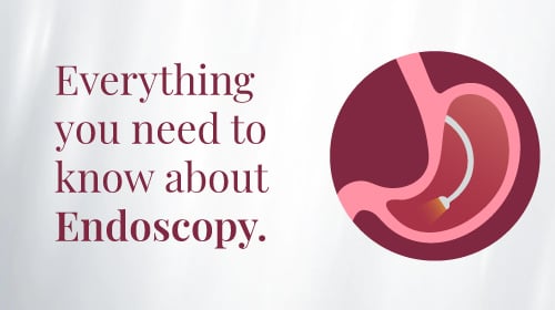What is Endoscopy? What is Endoscopy?