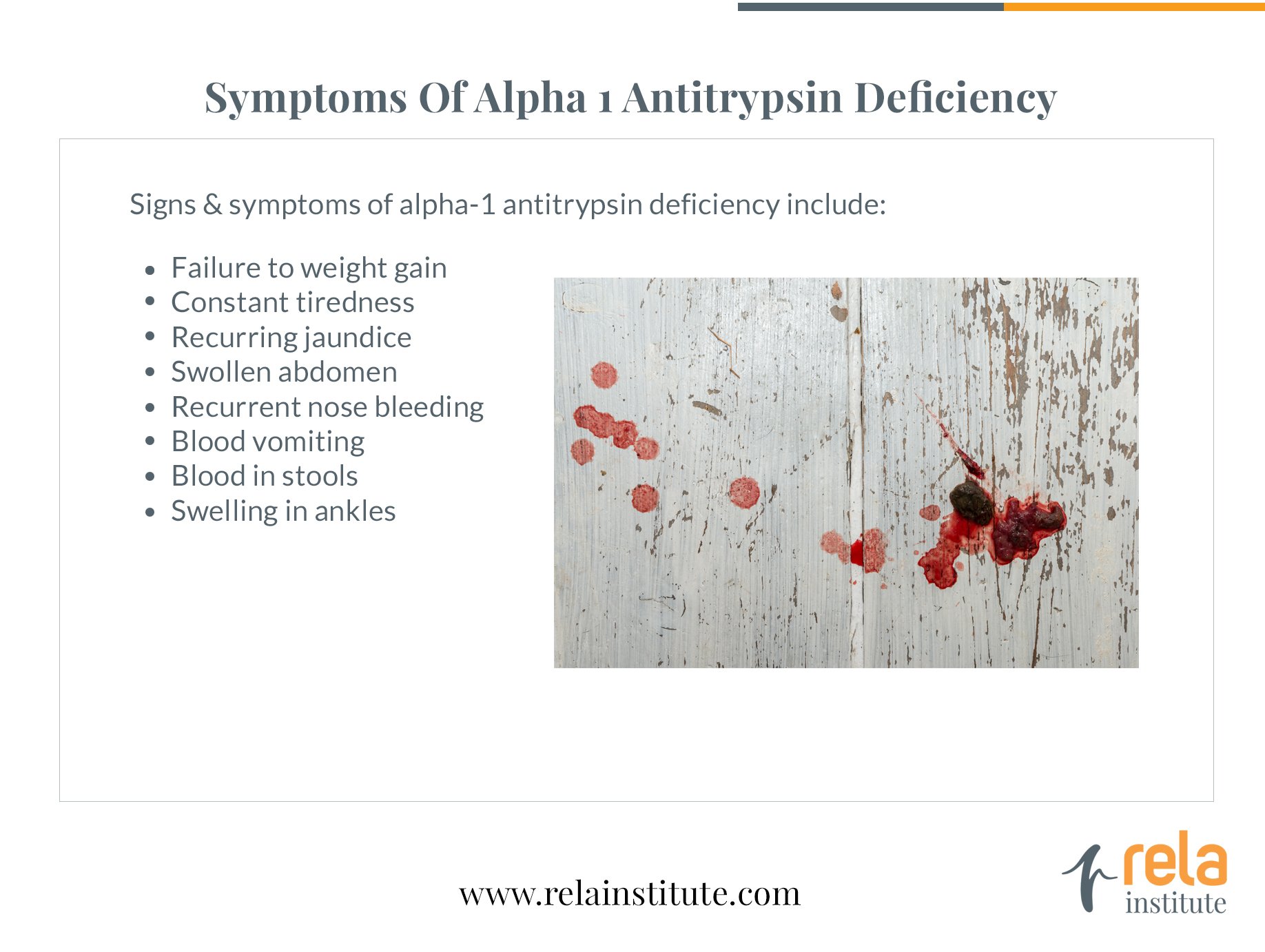 Alpha 1 Antitrypsin Deficiency