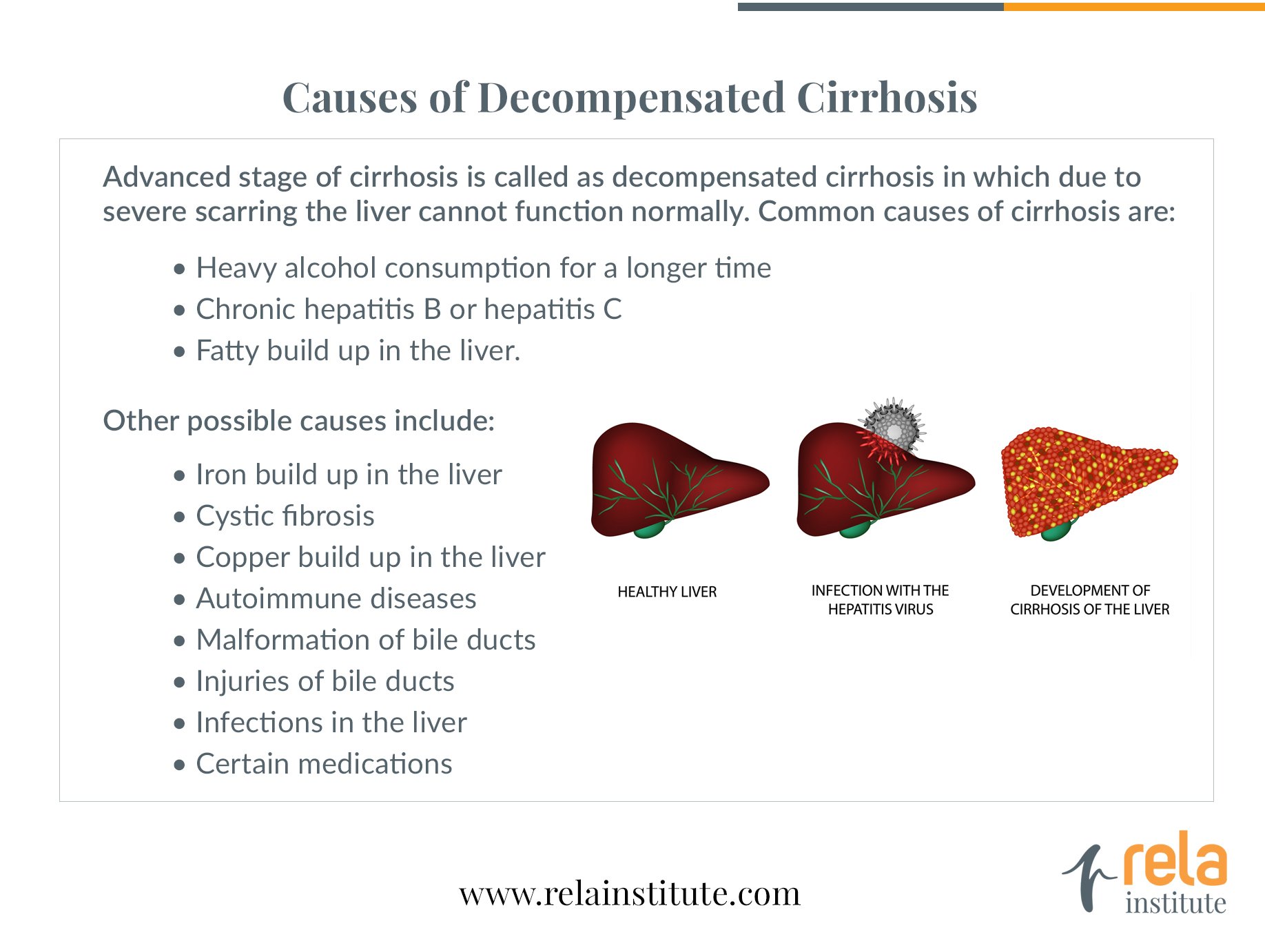 Decompensated Cirrhosis