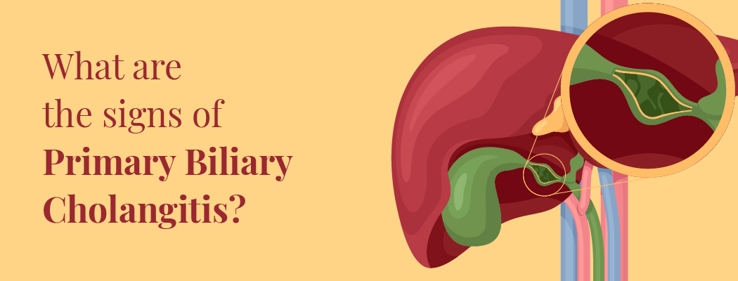 Primary Biliary Cholangitis : Causes and Symptoms