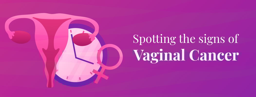 Vaginal Cancer: Symptoms and Causes Vaginal Cancer: Symptoms and Causes