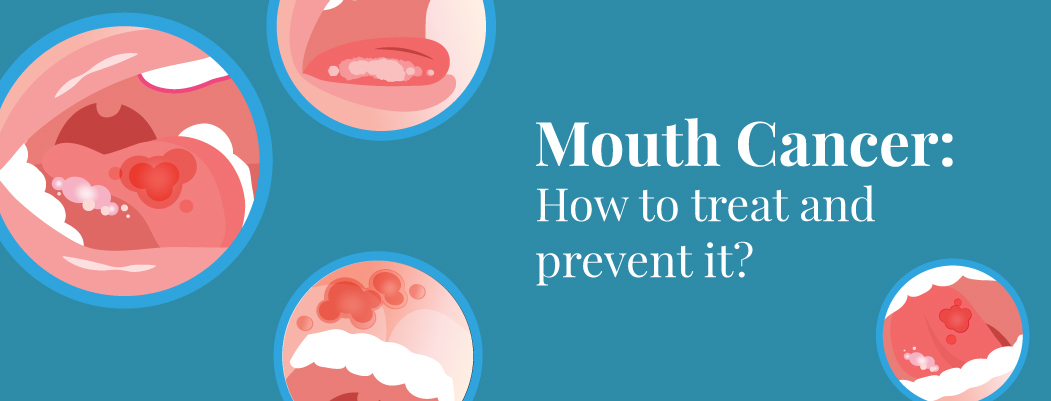 Is mouth cancer curable