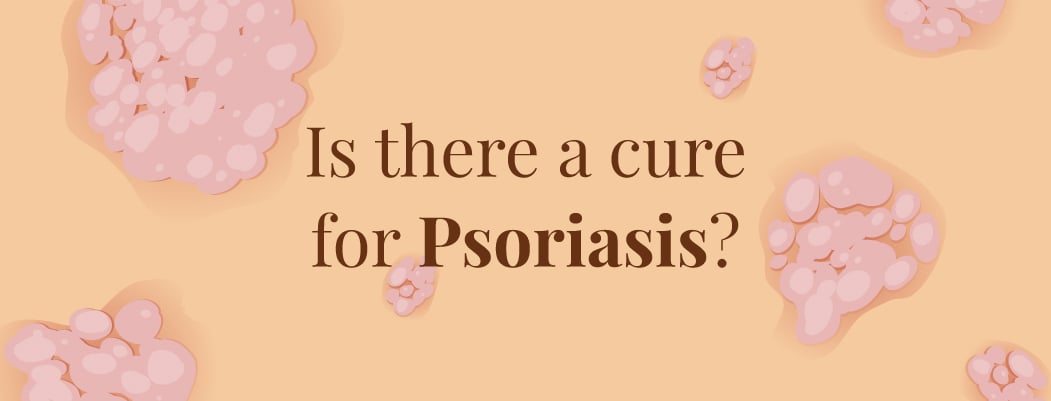 Is There a Cure for Psoriasis? Is There a Cure for Psoriasis?