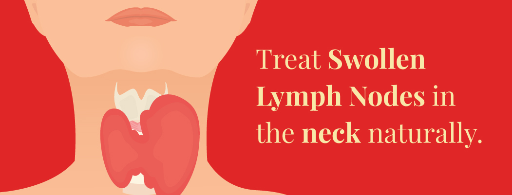 How to treat swollen lymph nodes in neck naturally