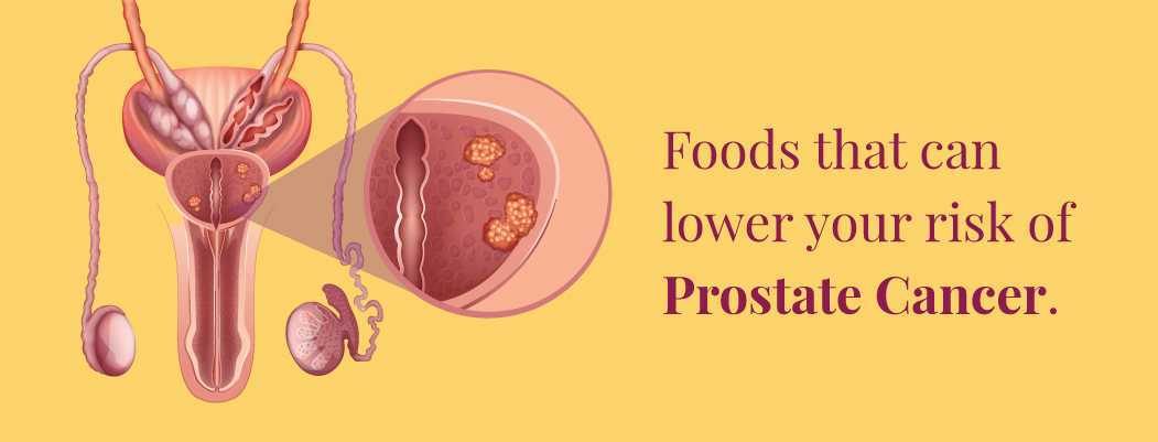 How to prevent prostate cancer