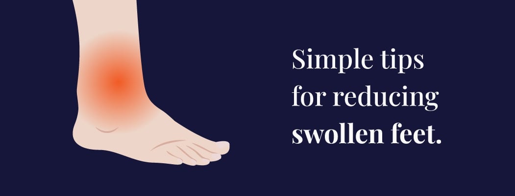 How to Reduce Swelling in Feet How to Reduce Swelling in Feet