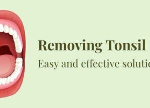 How to Remove Tonsil Stones
