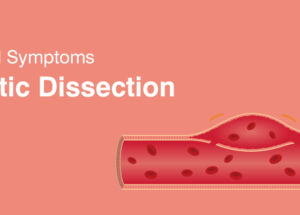 Aortic Dissection: Causes, Symptoms & Treatments