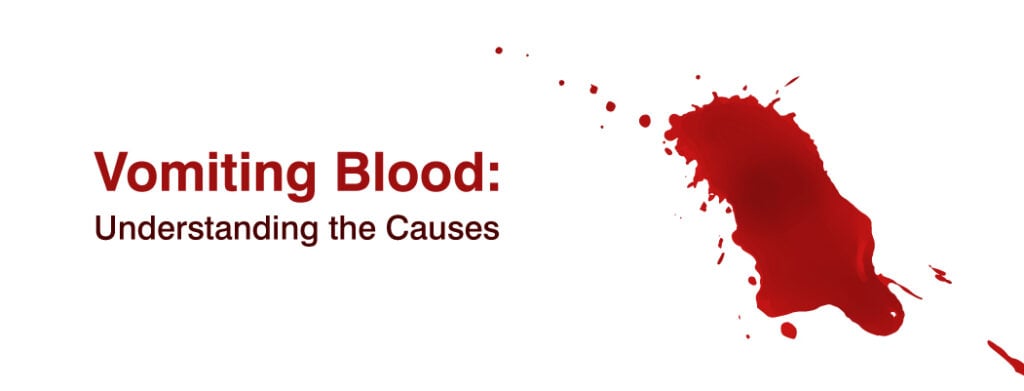 Reasons for vomiting blood