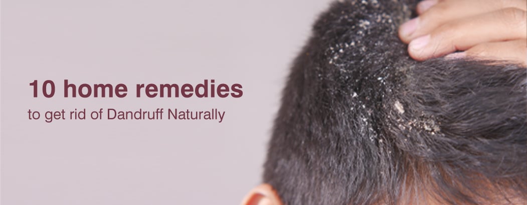 How to Get Rid of Dandruff and Hair Fall? How to Get Rid of Dandruff and Hair Fall?
