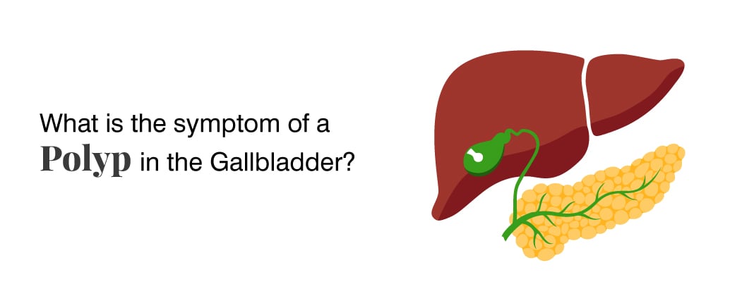 Gallbladder Polyps: Symptoms, Causes and Treatments Gallbladder Polyps: Symptoms, Causes and Treatments