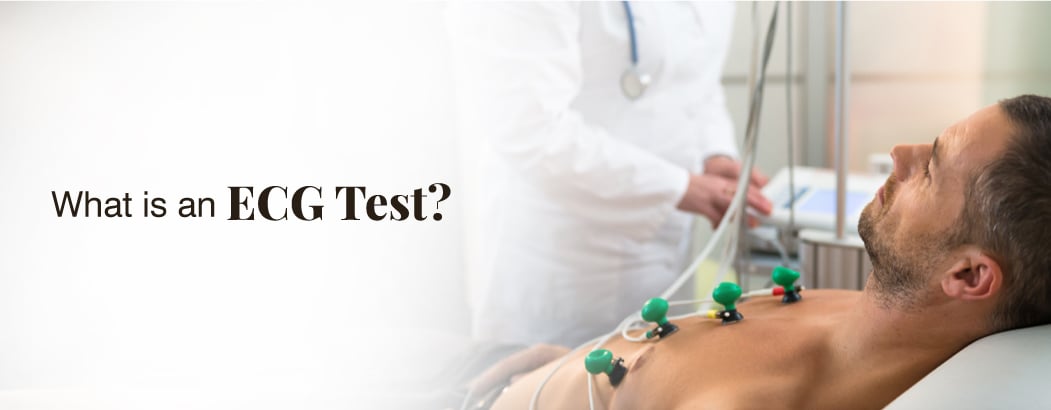 What is an ECG Test? What is an ECG Test?