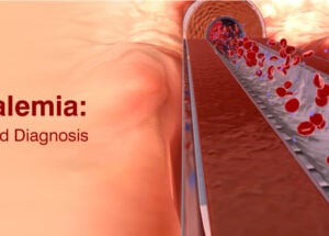 Hyperkalemia (High Potassium): Symptoms, Causes and Treatment