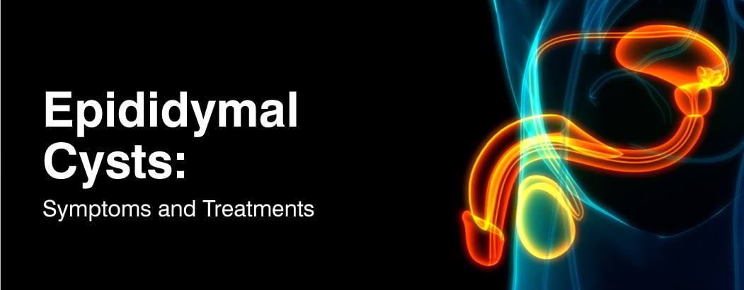 Epididymal Cysts: Symptoms, Diagnosis, and Treatments Epididymal Cysts: Symptoms, Diagnosis, and Treatments