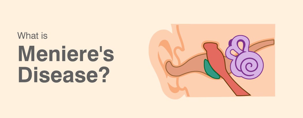 What is Meniere’s Disease?