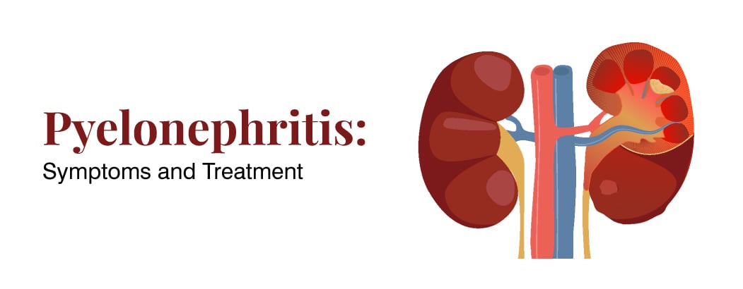 Pyelonephritis: Symptoms and Treatment Pyelonephritis: Symptoms and Treatment