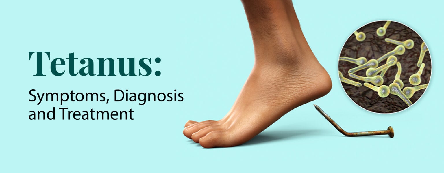 tetanus-symptoms-diagnosis-and-treatment-rela-hospital