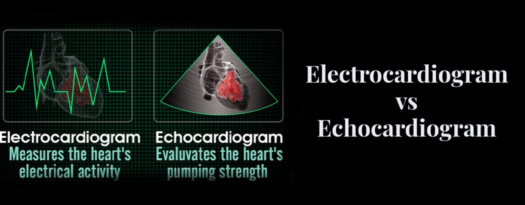 Electrocardiogram vs Echocardiogram: A Guide to Heart Health Electrocardiogram vs Echocardiogram: A Guide to Heart Health