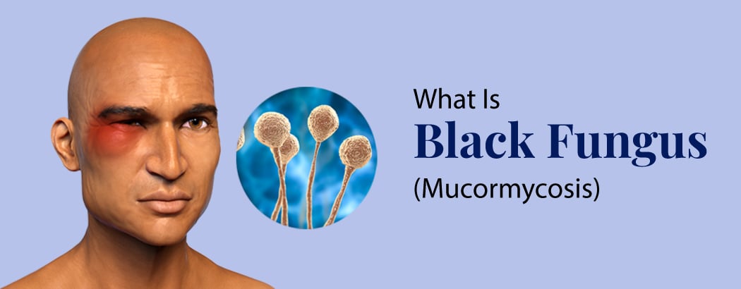 What is Black Fungus (Mucormycosis): Symptoms and Prevention Tips