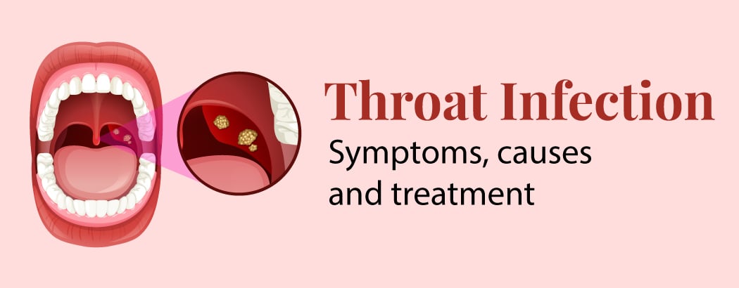 Throat Infection: Symptoms, Causes and Treatment Throat Infection: Symptoms, Causes and Treatment
